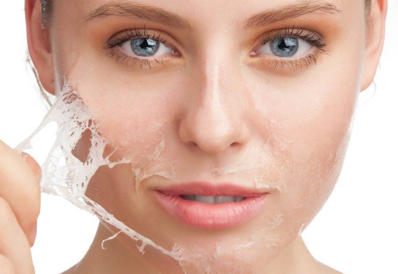 Tầm quan trọng của việc peel da